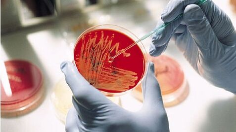 Bakterienkultur für Prostatitis, um Antibiotika zu verschreiben